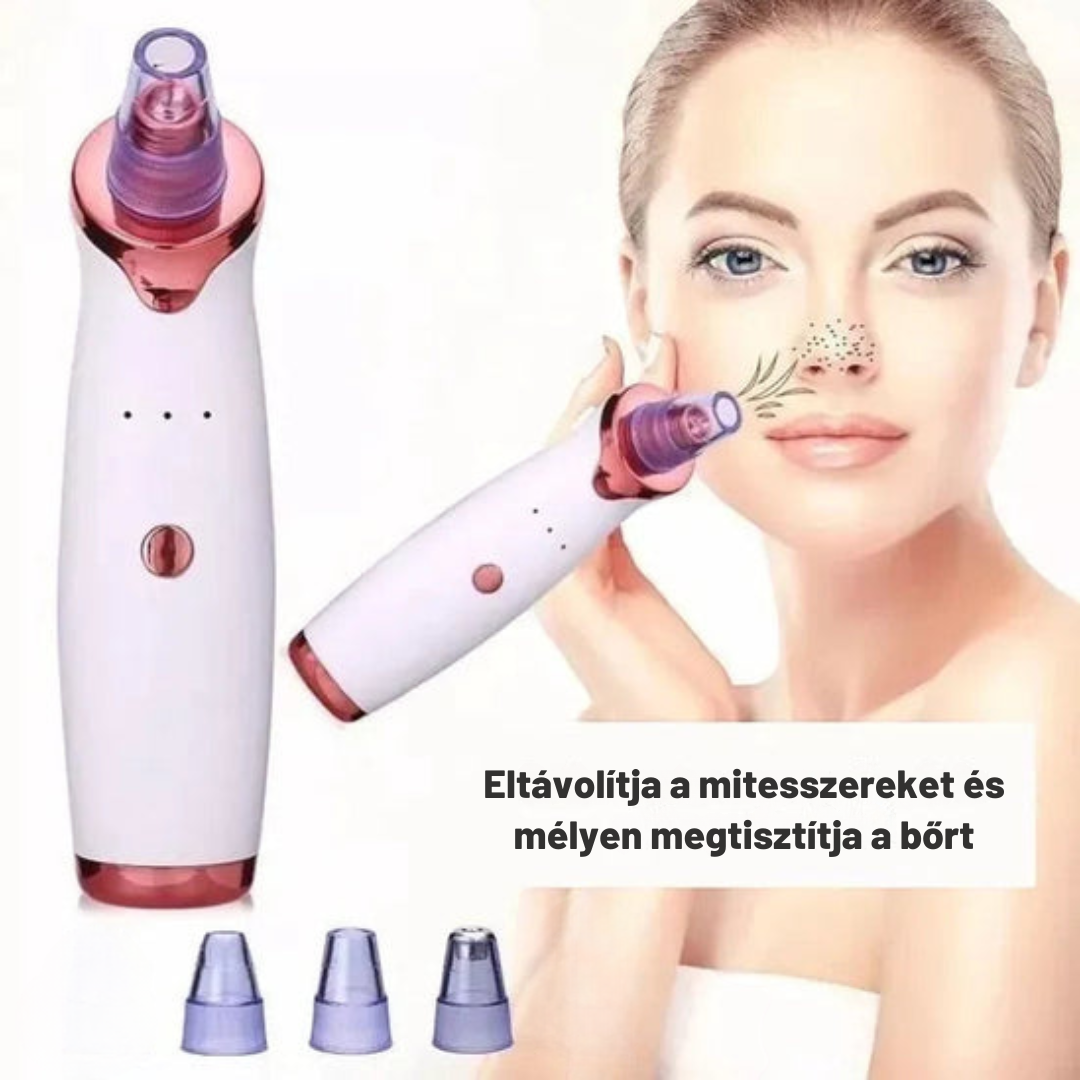Aknéeltávolító – Hatékony és fájdalommentes tisztítás