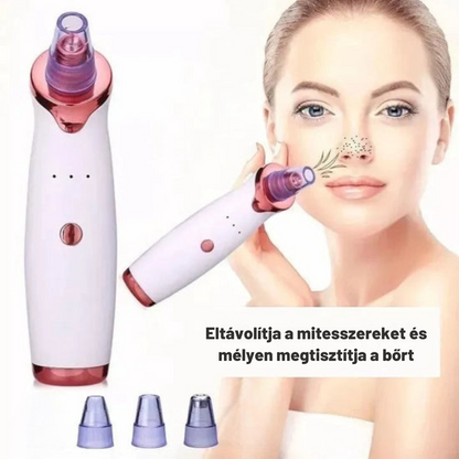 Aknéeltávolító – Hatékony és fájdalommentes tisztítás