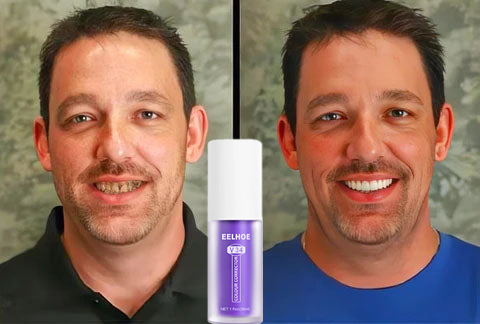 Fogszínkorrektor és zománcápoló szérum