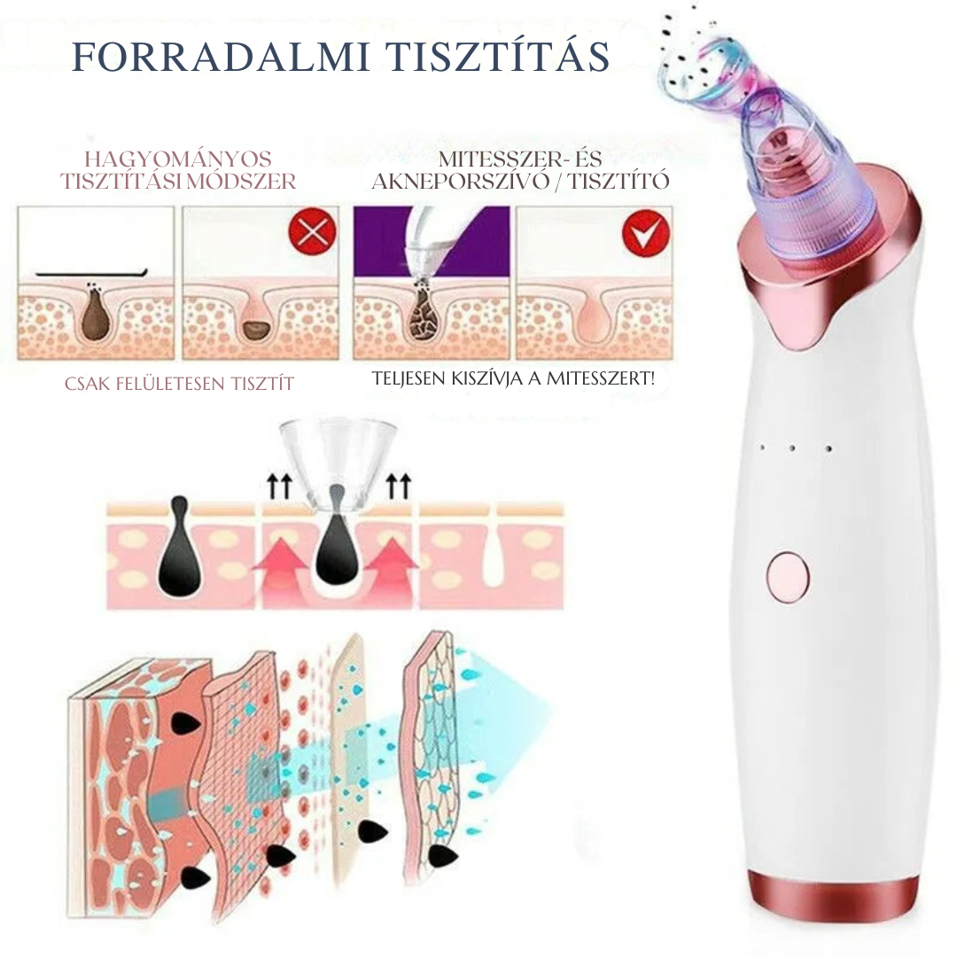 Aknéeltávolító – Hatékony és fájdalommentes tisztítás