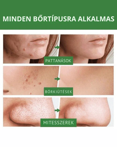 Green Mask – Zöld Tea Mélytisztító Maszk [AKCIÓ CSAK MA ÉRVÉNYES]