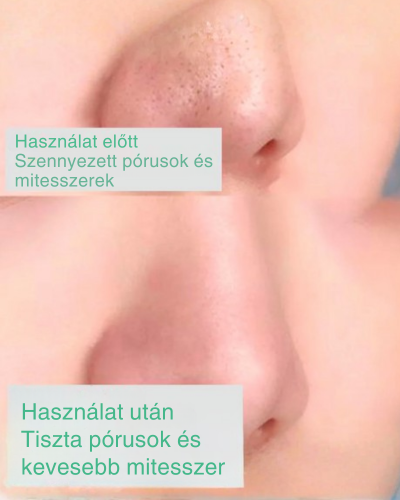 Green Mask – Zöld Tea Mélytisztító Maszk [AKCIÓ CSAK MA ÉRVÉNYES]