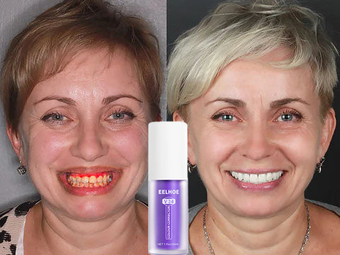 Fogszínkorrektor és zománcápoló szérum