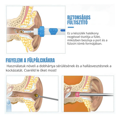 Elektromos Fültisztító – Biztonságos és Kényelmes Higiénia