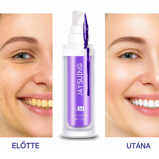 GlumiWhite – V34 Fehérítő – [AKCIÓ CSAK MA ÉRVÉNYES]