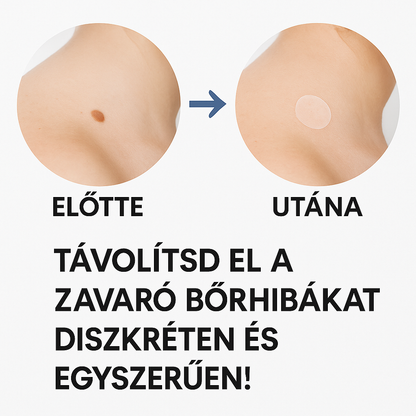 Láthatatlan Bőrhámlasztó Tapaszok – Diszkrét Védelem A Tiszta Bőrért