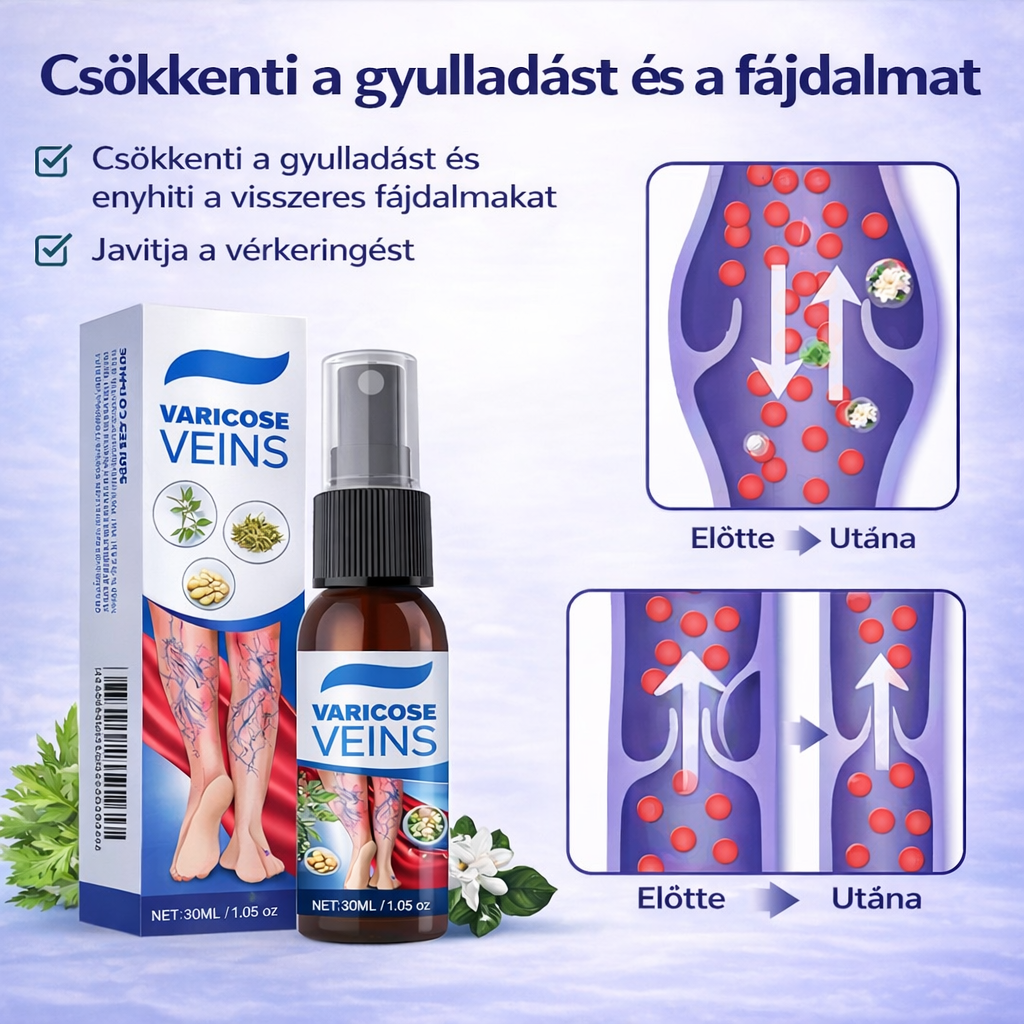 Visszér Spray – Kényelem És Gondoskodás A Lábaidnak