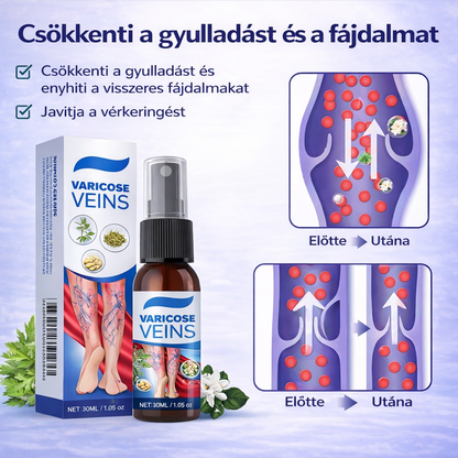 Visszér Spray – Kényelem És Gondoskodás A Lábaidnak
