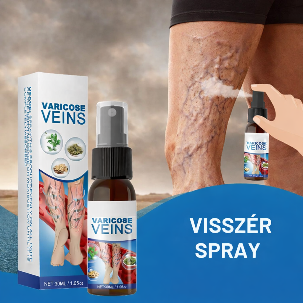 Visszér Spray – Kényelem És Gondoskodás A Lábaidnak