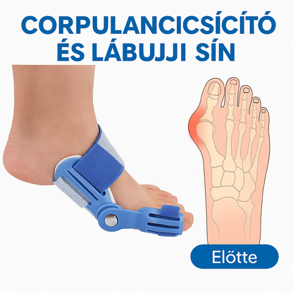 PlasticBunion – Bütyökkorrigáló és Lábujj-kiegyenesítő Sín