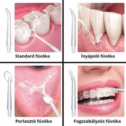 Fogászati Irrigátor – Mélytisztítás És Friss Lehelet
