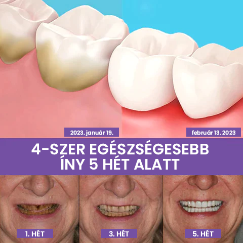 Fogszínkorrektor és zománcápoló szérum