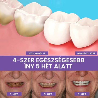 Fogszínkorrektor és zománcápoló szérum