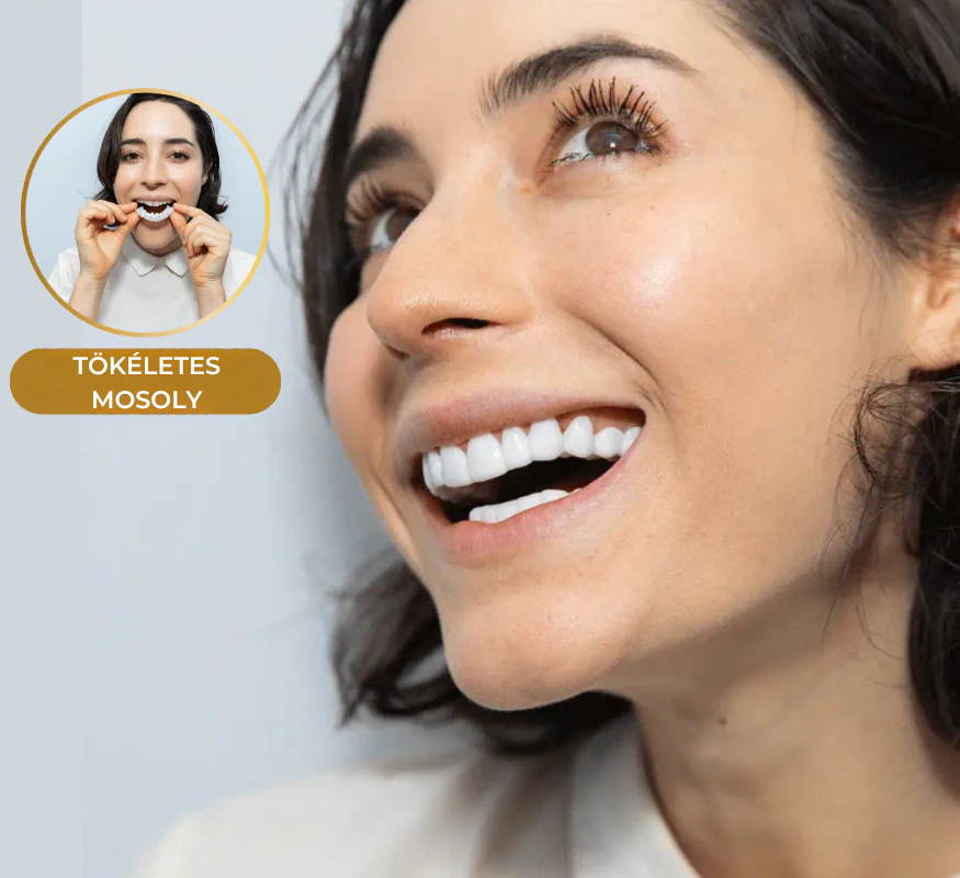 Felpattintható Foghéj - Kényelmes viselet egész nap