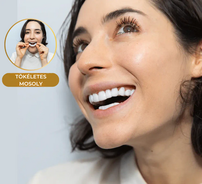 Felpattintható Foghéj - Kényelmes viselet egész nap