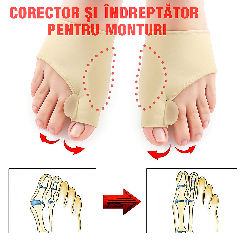 OrtoFix – Ortopéd korrektor a bütyök fájdalom ellen